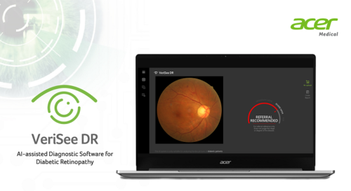 Acer To Expand Diabetic Retinopathy Screening By Launching AI-assisted ...